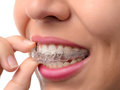 Rosenstein   Gartner Dentistry, PLLC | Digital Radiography, Teeth Whitening and Dental Cleanings   Hygiene
