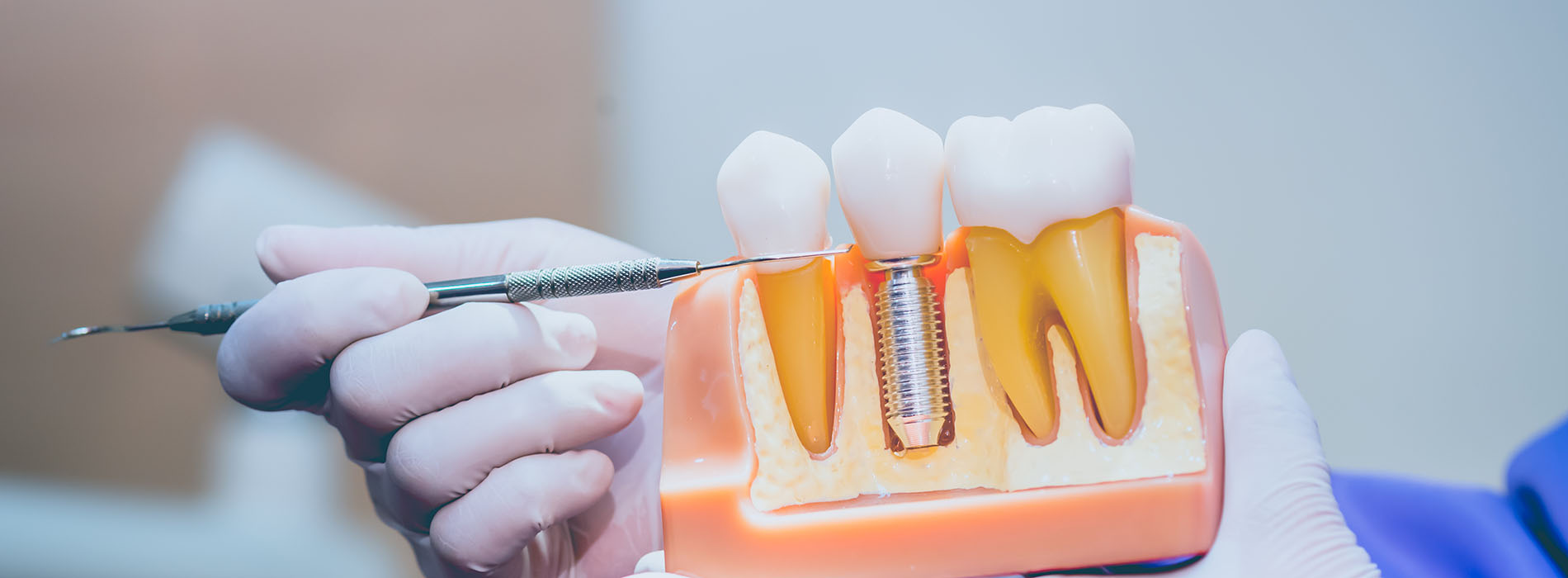 Rosenstein   Gartner Dentistry, PLLC | Digital Impressions, Periodontal Treatment and Complete   Partial Dentures